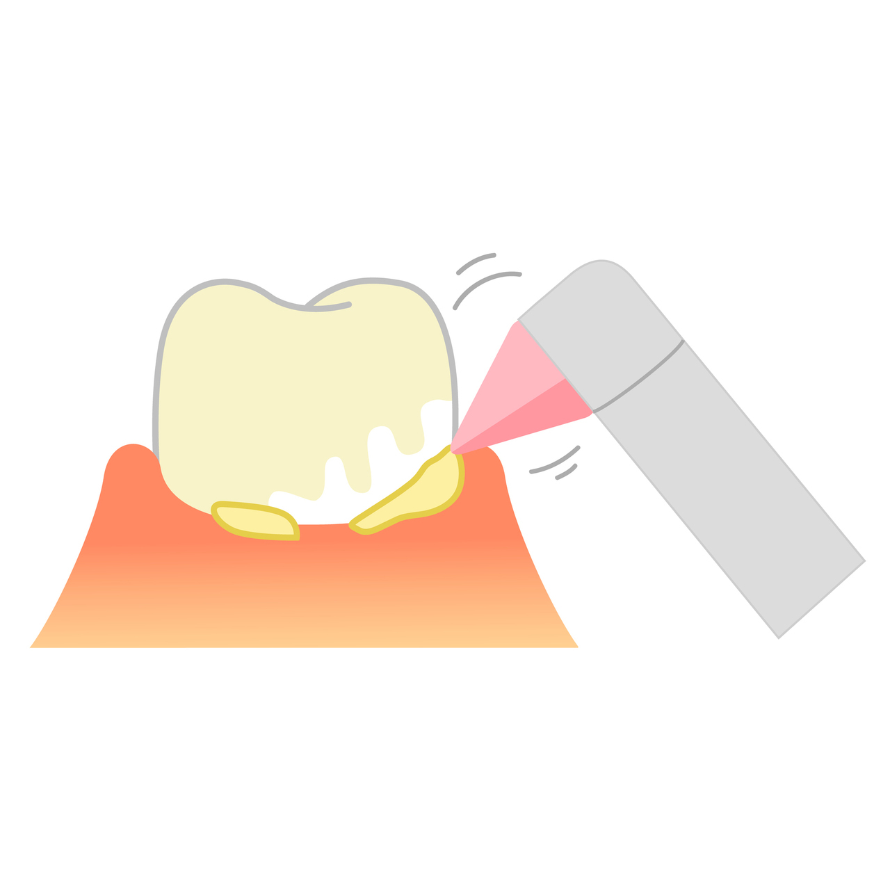 吉祥寺の予防歯科・定期検診