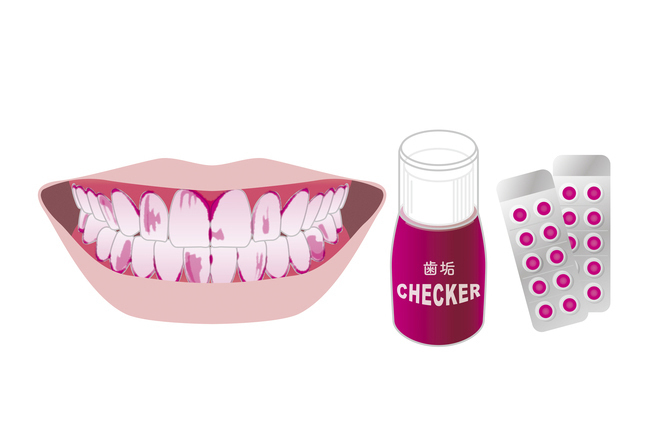 吉祥寺の予防歯科・定期検診