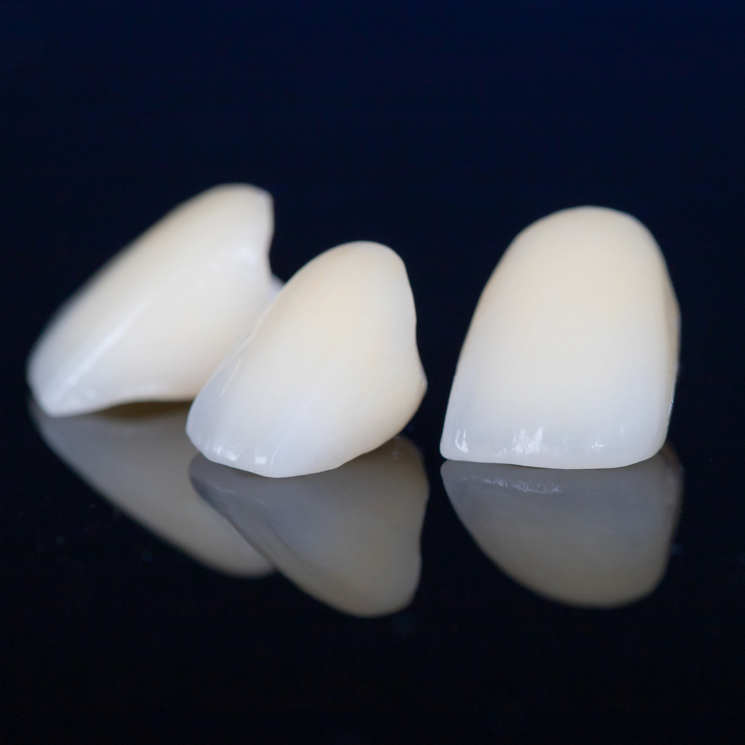 吉祥寺のセラミック治療