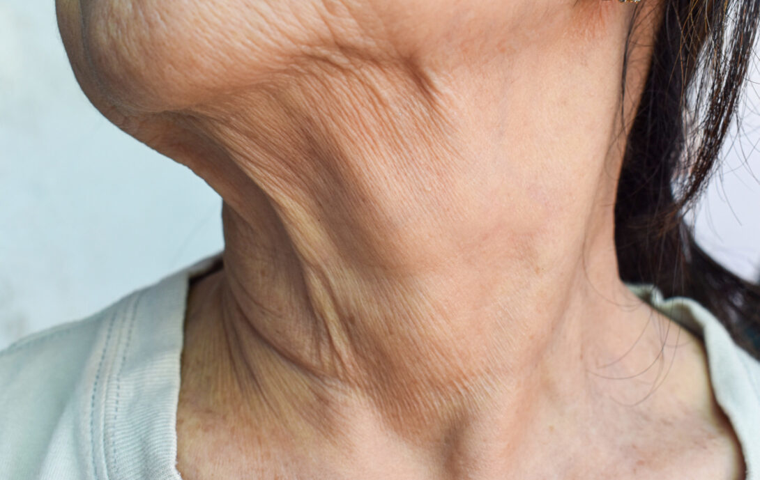 吉祥寺の60代からの歯科治療｜口腔機能低下症