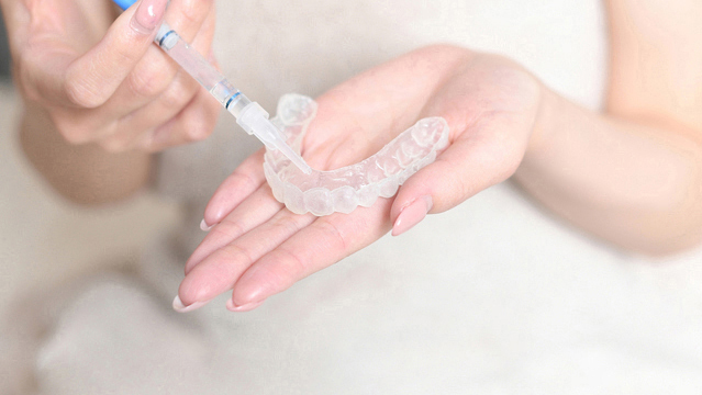 吉祥寺のホワイトニング