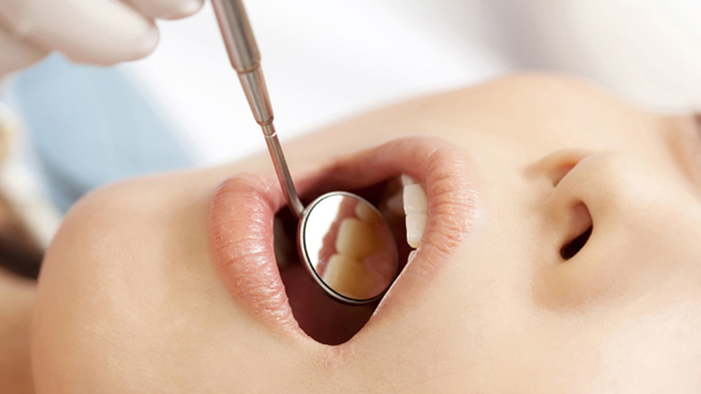 吉祥寺のセラミック治療