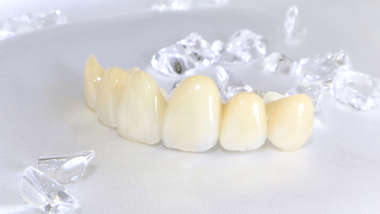 吉祥寺のセラミック治療