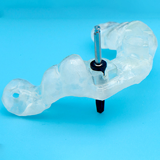 吉祥寺のインプラント治療