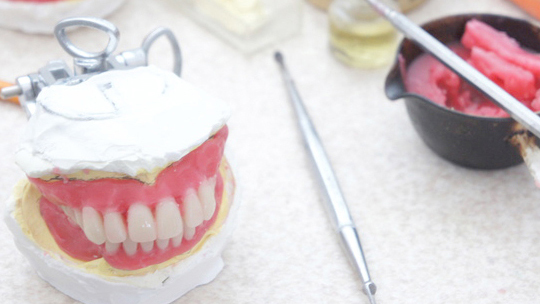 吉祥寺の審美歯科(白い詰め物・被せ物)