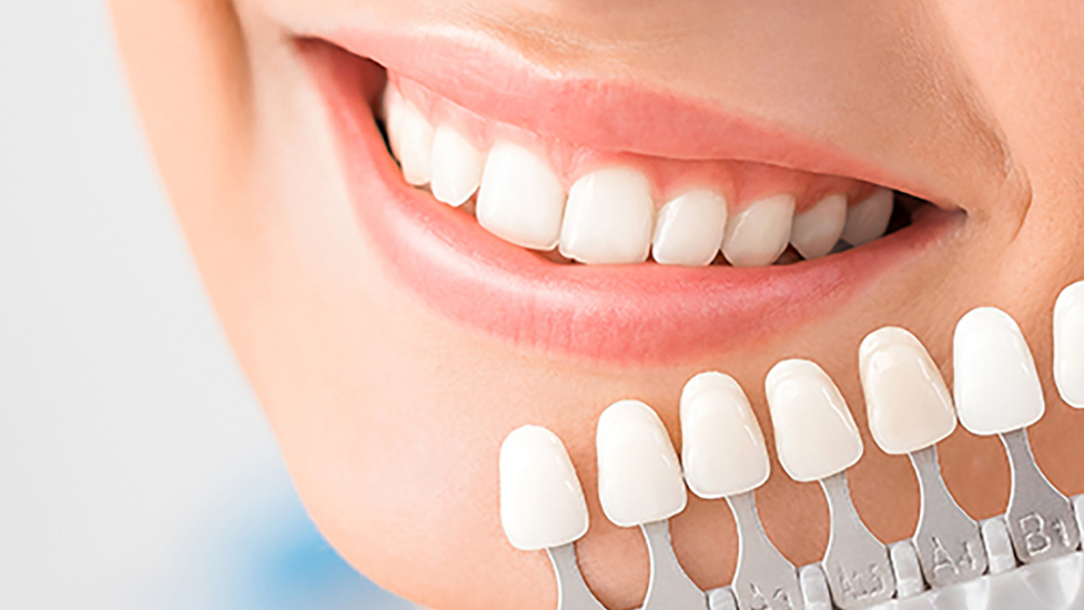 吉祥寺のホワイトニング