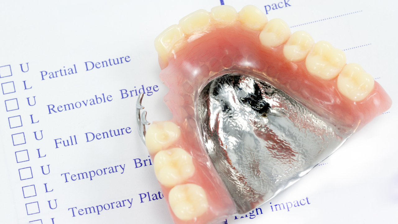 吉祥寺の入れ歯・義歯治療