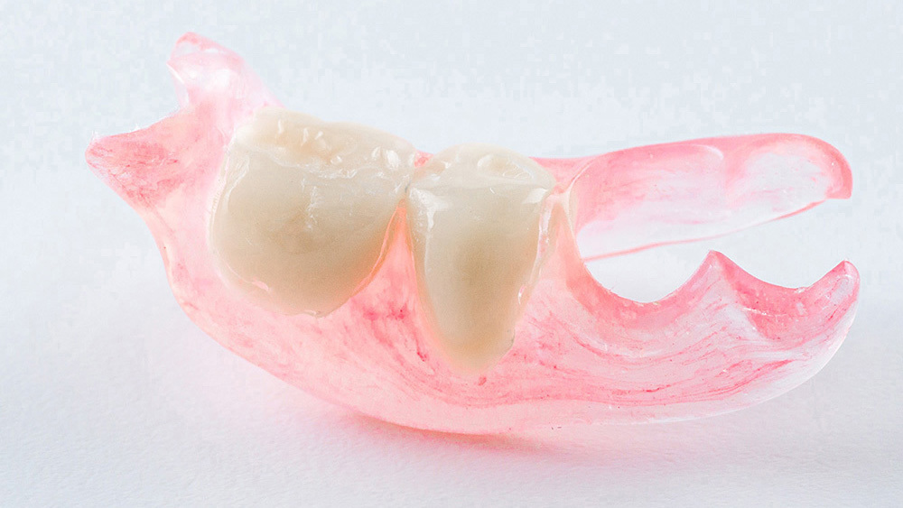 吉祥寺の入れ歯・義歯治療