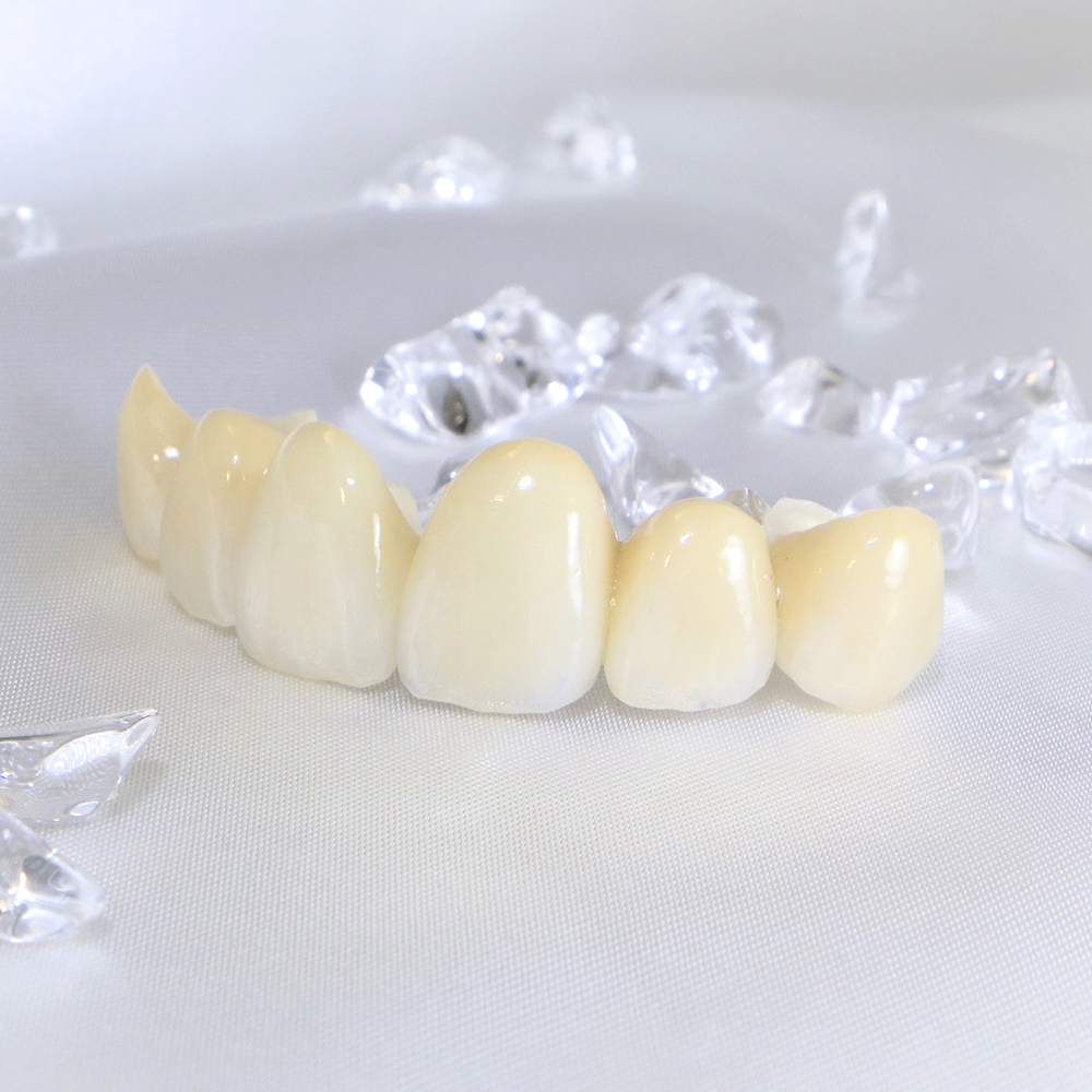 吉祥寺の審美歯科(白い詰め物・被せ物)
