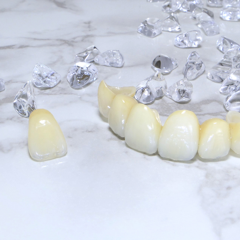 吉祥寺のセラミック治療