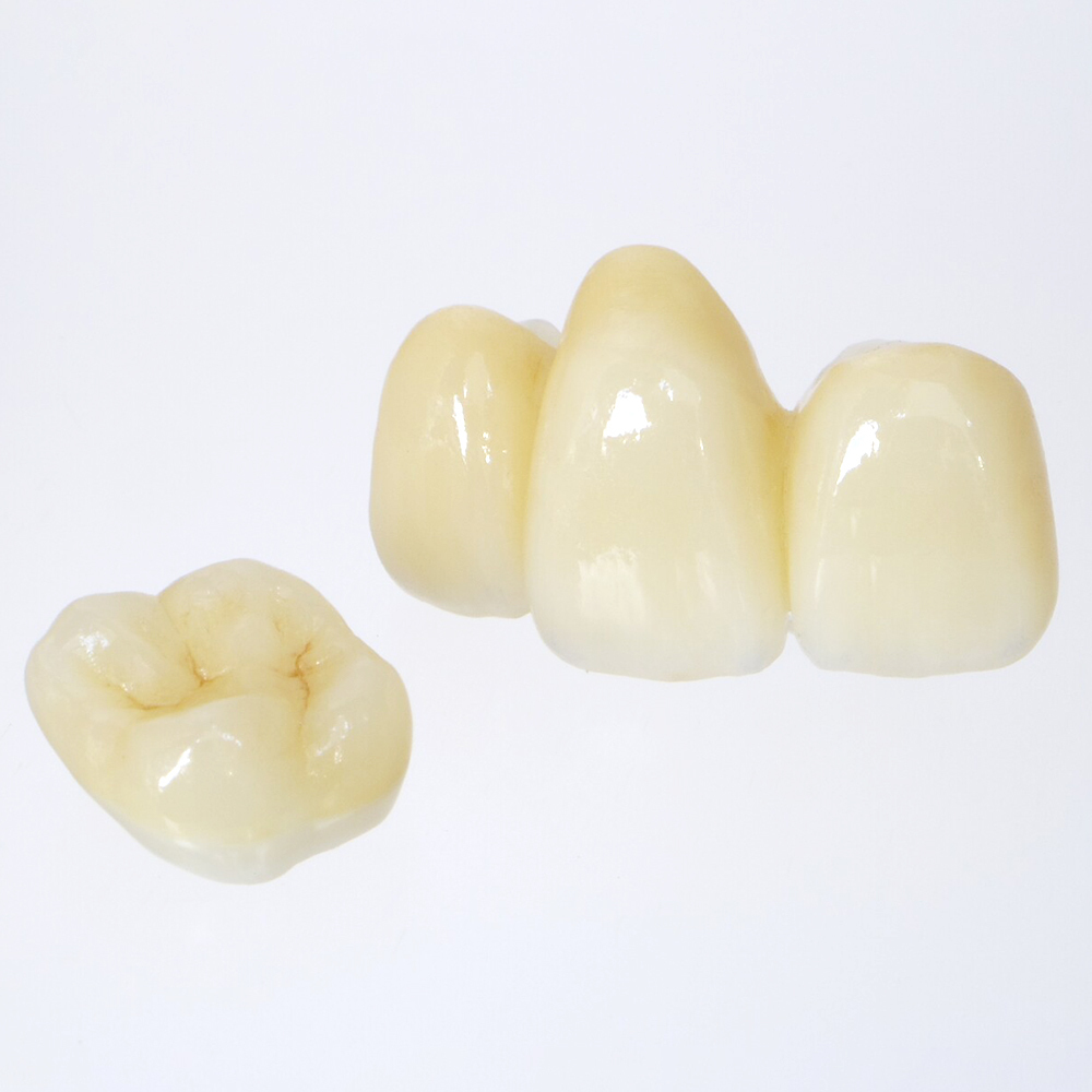 吉祥寺の審美歯科(白い詰め物・被せ物)