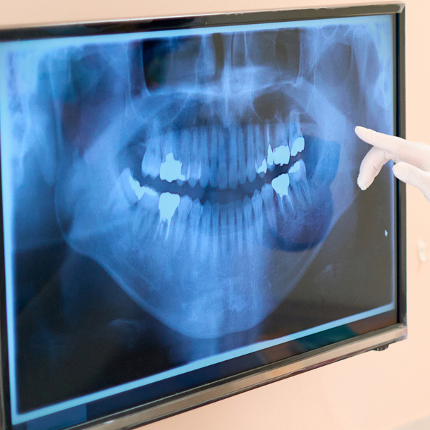 吉祥寺の歯周病の治療