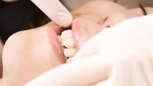 吉祥寺のセラミック治療