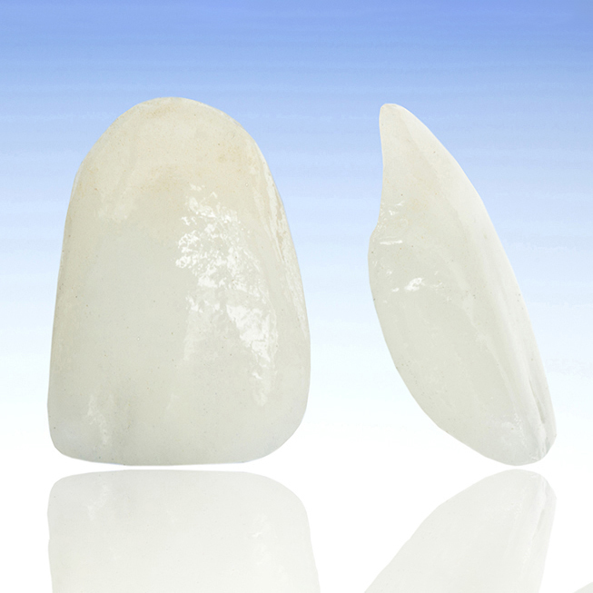 吉祥寺の審美歯科(白い詰め物・被せ物)