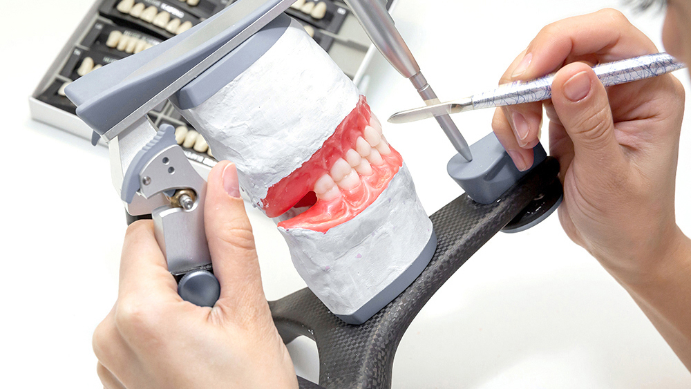 吉祥寺の入れ歯・義歯治療